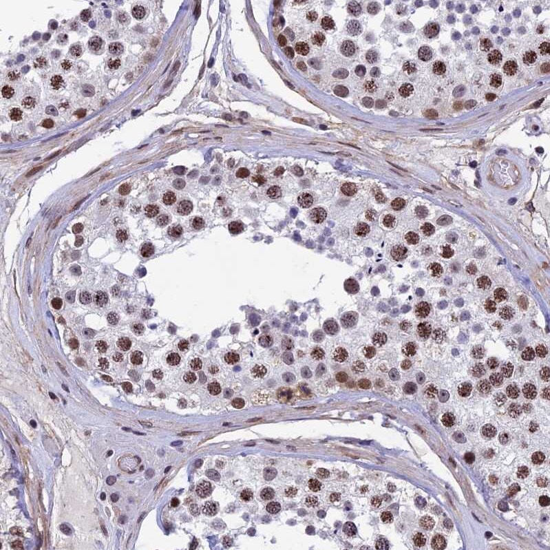 NIPBL Antibody - BSA Free Immunohistochemistry-Paraffin: NIPBL Antibody [NBP1-85110]
