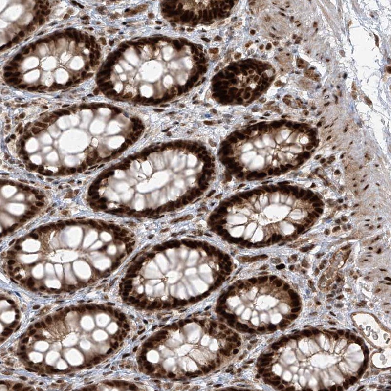 ARHGEF3 Antibody - BSA Free Immunohistochemistry-Paraffin: ARHGEF3 Antibody [NBP1-85130]