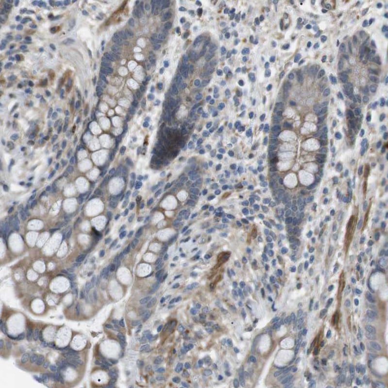KANK2 Antibody - BSA Free Immunohistochemistry: KANK2 Antibody [NBP1-89080]