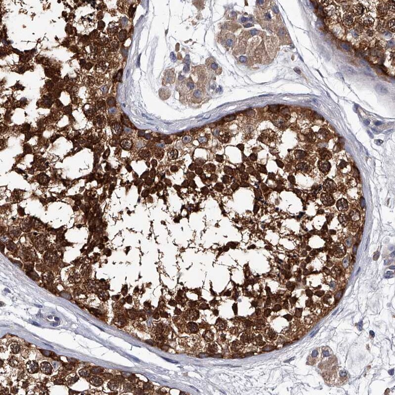 RAP6 Antibody Immunohistochemistry-Paraffin: RAP6 Antibody [NBP1-85137] -