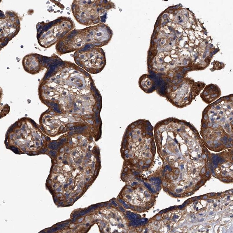 RAP6 Antibody Immunohistochemistry-Paraffin: RAP6 Antibody [NBP1-85137] -
