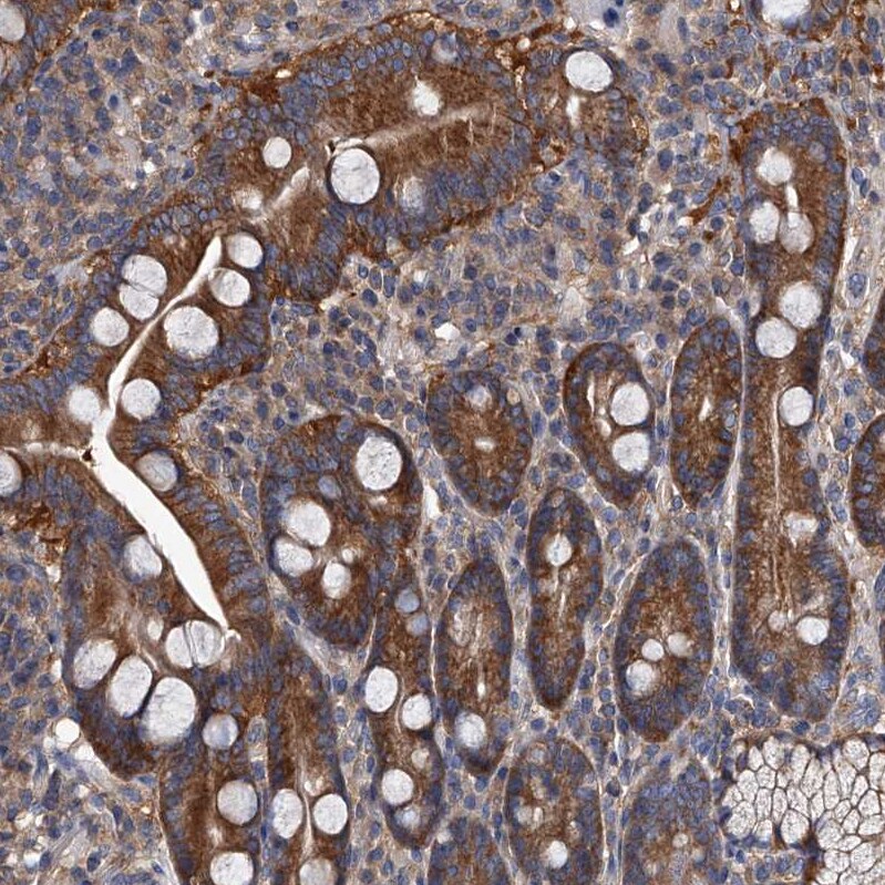 RAP6 Antibody Immunohistochemistry-Paraffin: RAP6 Antibody [NBP1-85137] -