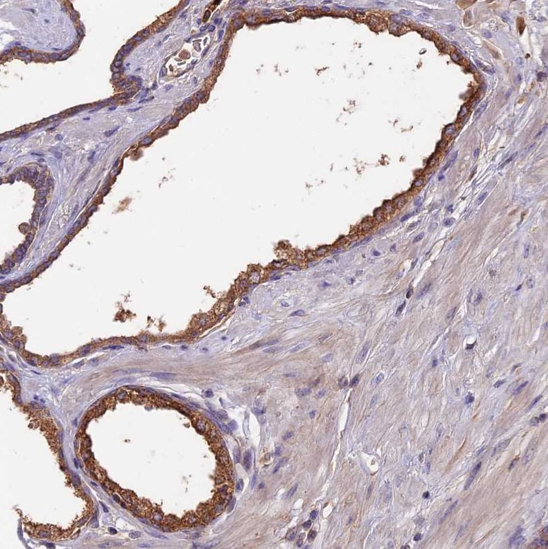 GPR133 Antibody Immunohistochemistry: GPR133 Antibody [GPR133 Antibody]
