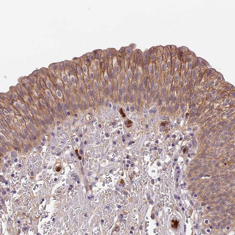 GPR133 Antibody Immunohistochemistry: GPR133 Antibody [GPR133 Antibody]