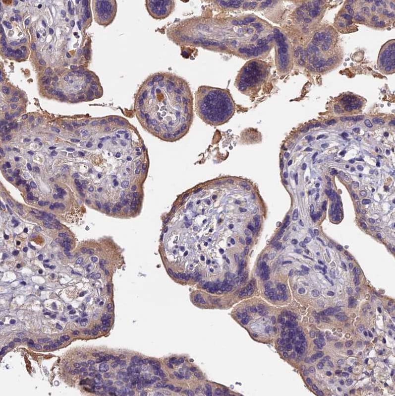 GPR133 Antibody Immunohistochemistry: GPR133 Antibody [GPR133 Antibody]