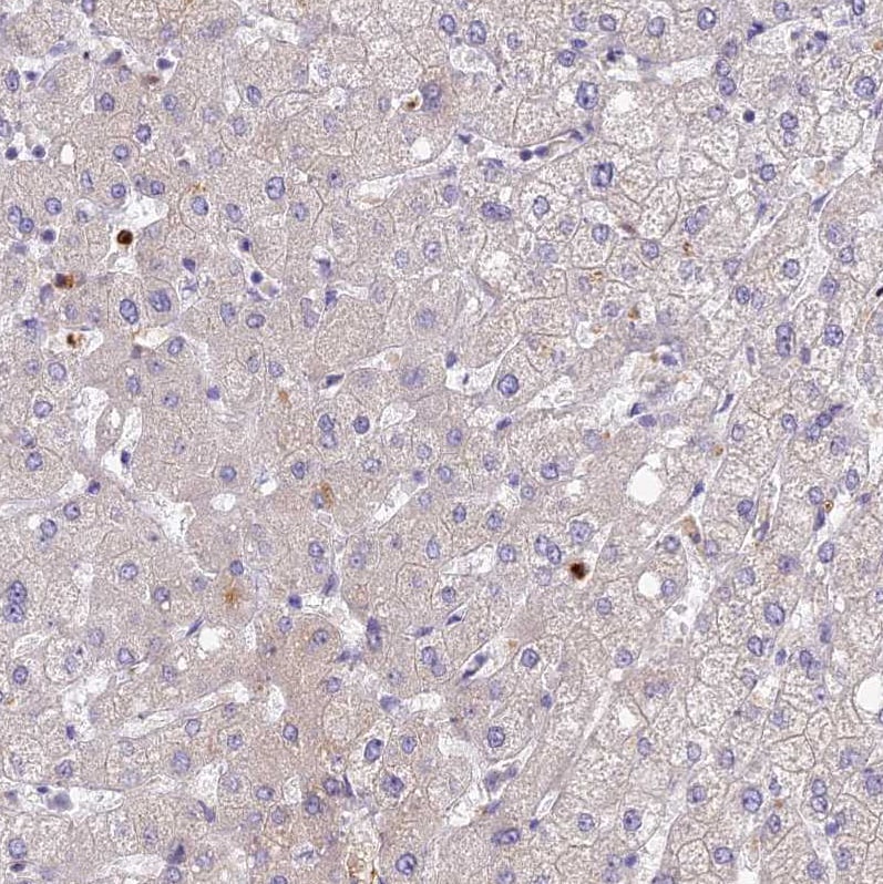 GPR133 Antibody Immunohistochemistry: GPR133 Antibody [GPR133 Antibody]