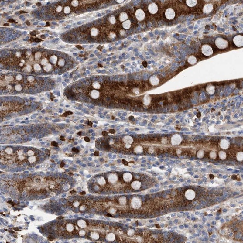 CRISPLD2 Antibody - BSA Free Immunohistochemistry-Paraffin: CRISPLD2 Antibody [NBP1-85143]