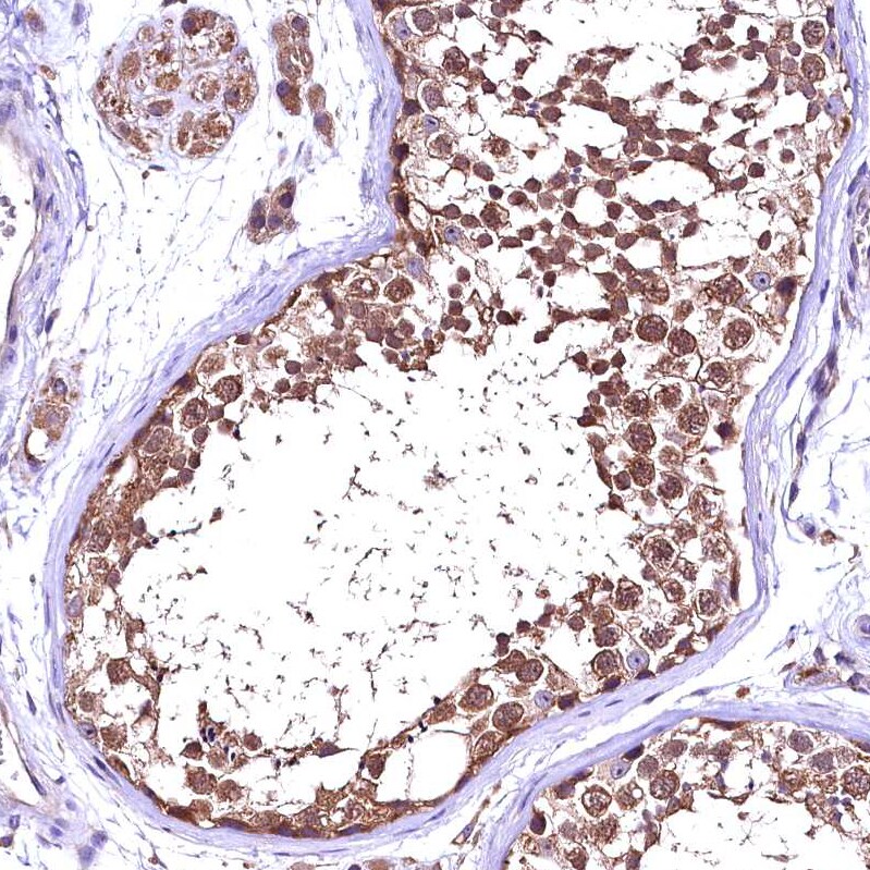 ENKD1 Antibody - BSA Free Immunohistochemistry-Paraffin: ENKD1 Antibody [NBP1-85148]