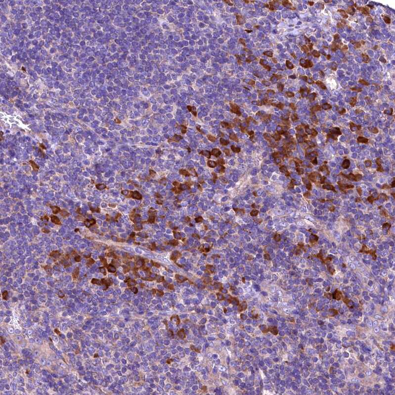 ENKD1 Antibody - BSA Free Immunohistochemistry-Paraffin: ENKD1 Antibody [NBP1-85148]
