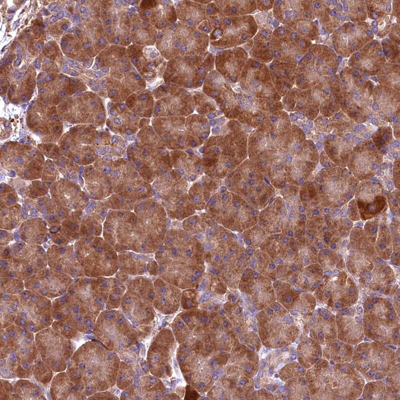 ENKD1 Antibody - BSA Free Immunohistochemistry-Paraffin: ENKD1 Antibody [NBP1-85148]