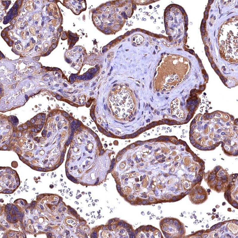 ENKD1 Antibody - BSA Free Immunohistochemistry-Paraffin: ENKD1 Antibody [NBP1-85148]