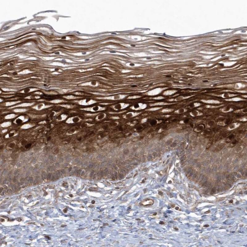 ARMC8 Antibody - BSA Free Immunohistochemistry-Paraffin: ARMC8 Antibody [NBP1-85149]