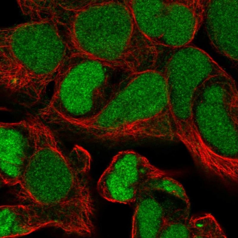 ZSCAN16 Antibody - BSA Free Immunocytochemistry/ Immunofluorescence: ZSCAN16 Antibody [NBP1-85184]