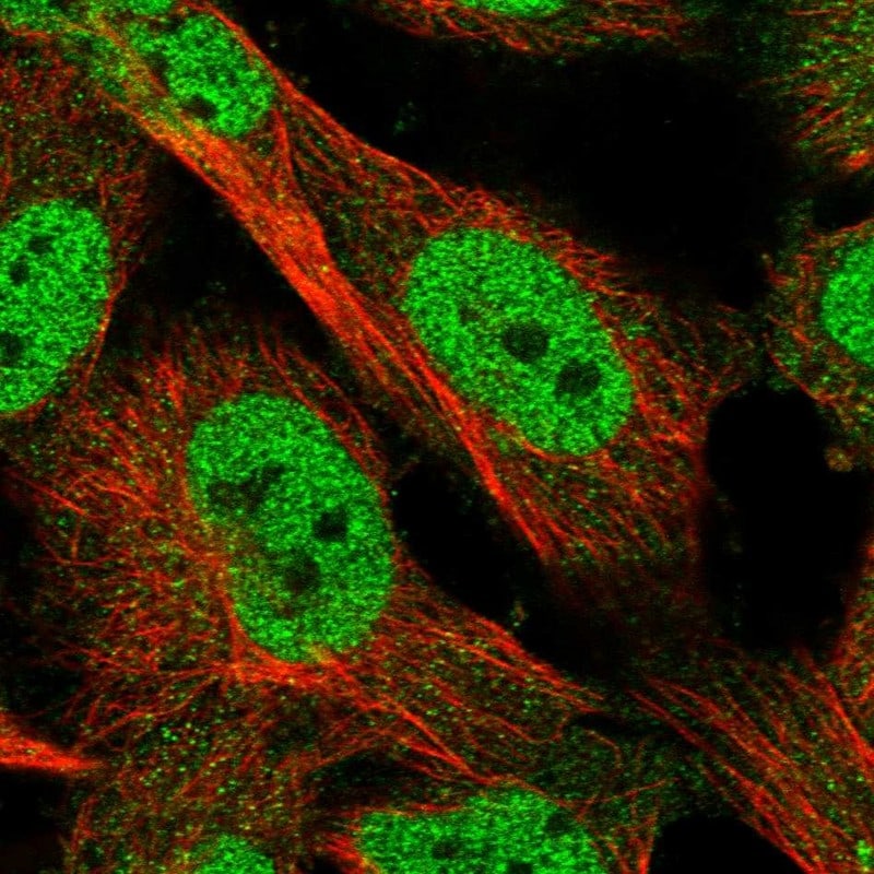KLHDC3 Antibody - BSA Free Immunocytochemistry/ Immunofluorescence: KLHDC3 Antibody [NBP1-85196]