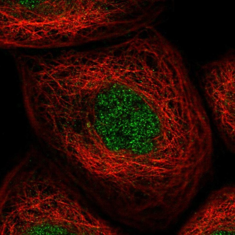 KLHDC3 Antibody - BSA Free Immunocytochemistry/ Immunofluorescence: KLHDC3 Antibody [NBP1-85198]