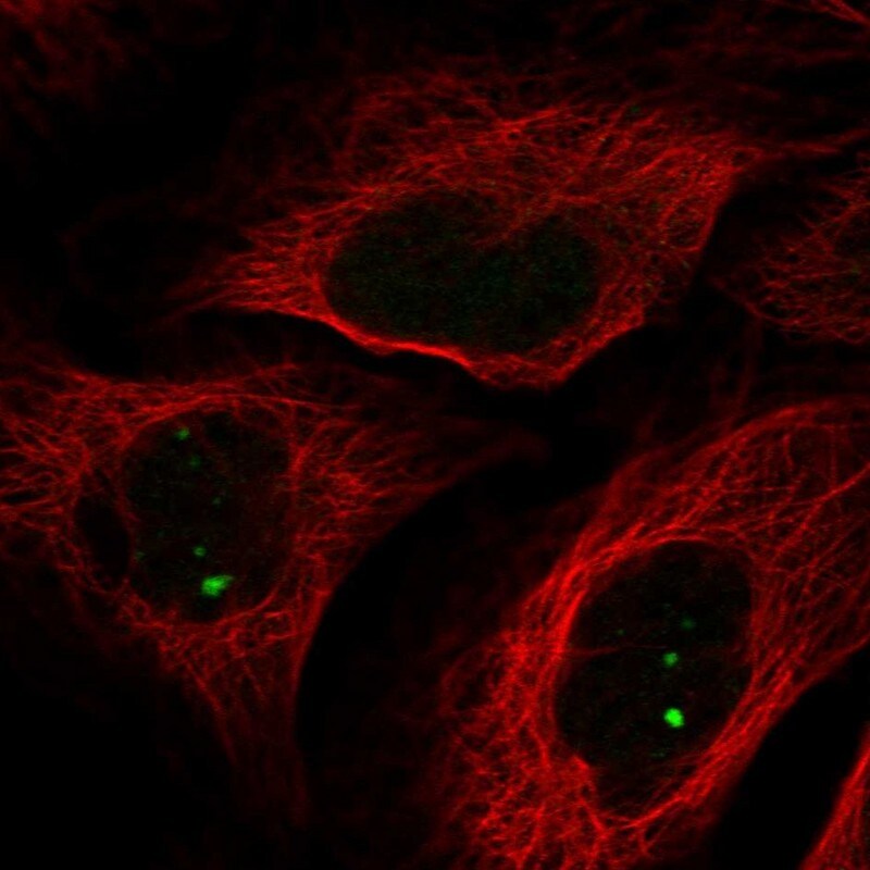 NCOA7 Antibody - BSA Free Immunocytochemistry/ Immunofluorescence: NCOA7 Antibody [NBP1-85199]