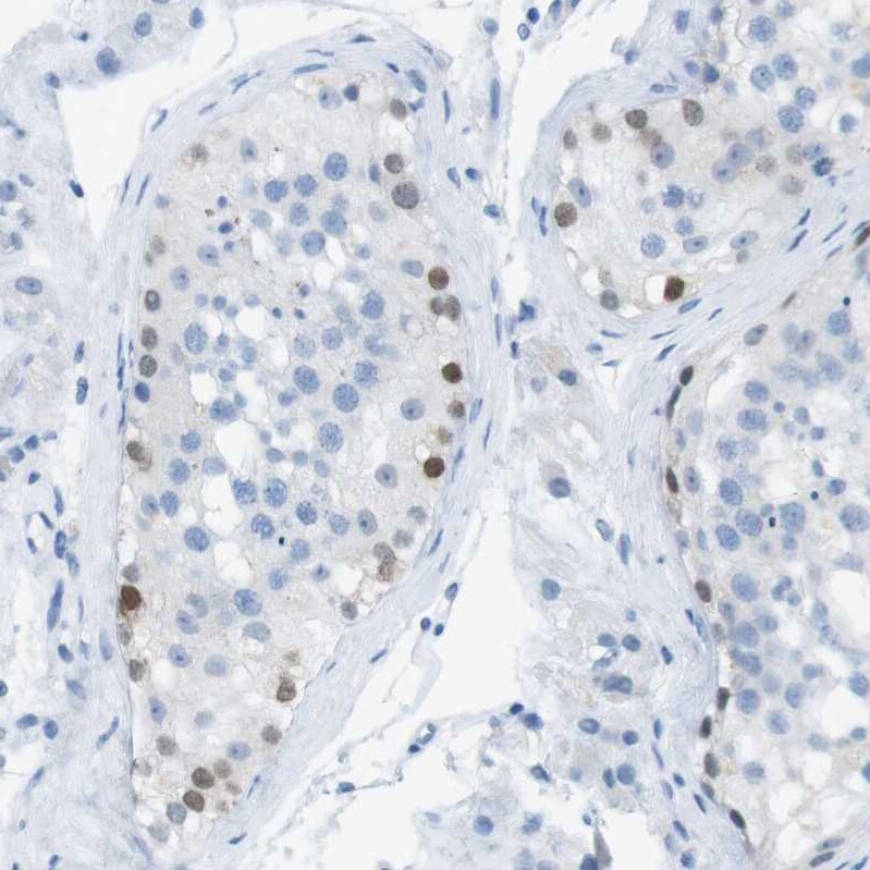 SALL4 Antibody - BSA Free Immunohistochemistry-Paraffin: SALL4 Antibody [NBP1-85206]