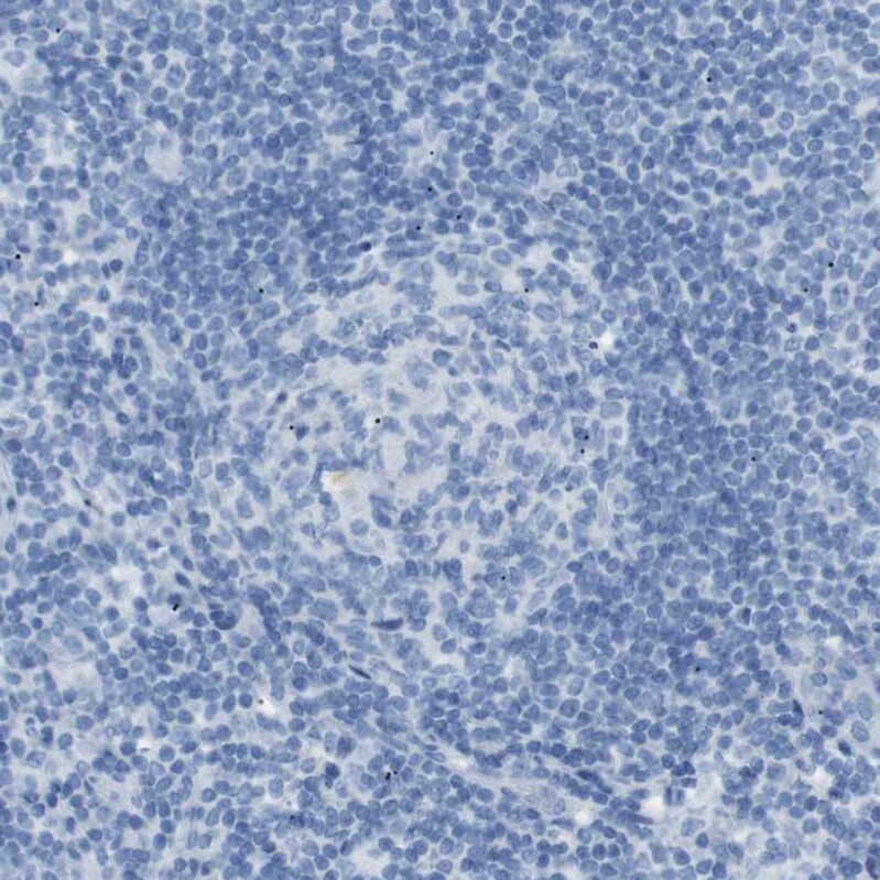 SALL4 Antibody - BSA Free Immunohistochemistry-Paraffin: SALL4 Antibody [NBP1-85206]
