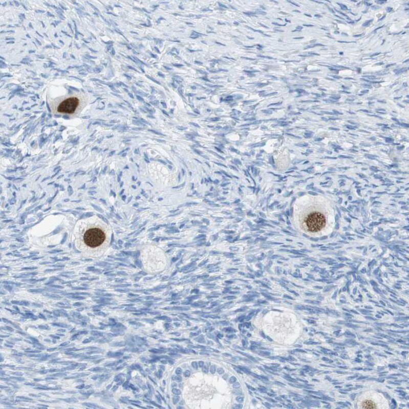 SALL4 Antibody - BSA Free Immunohistochemistry-Paraffin: SALL4 Antibody [NBP1-85206]
