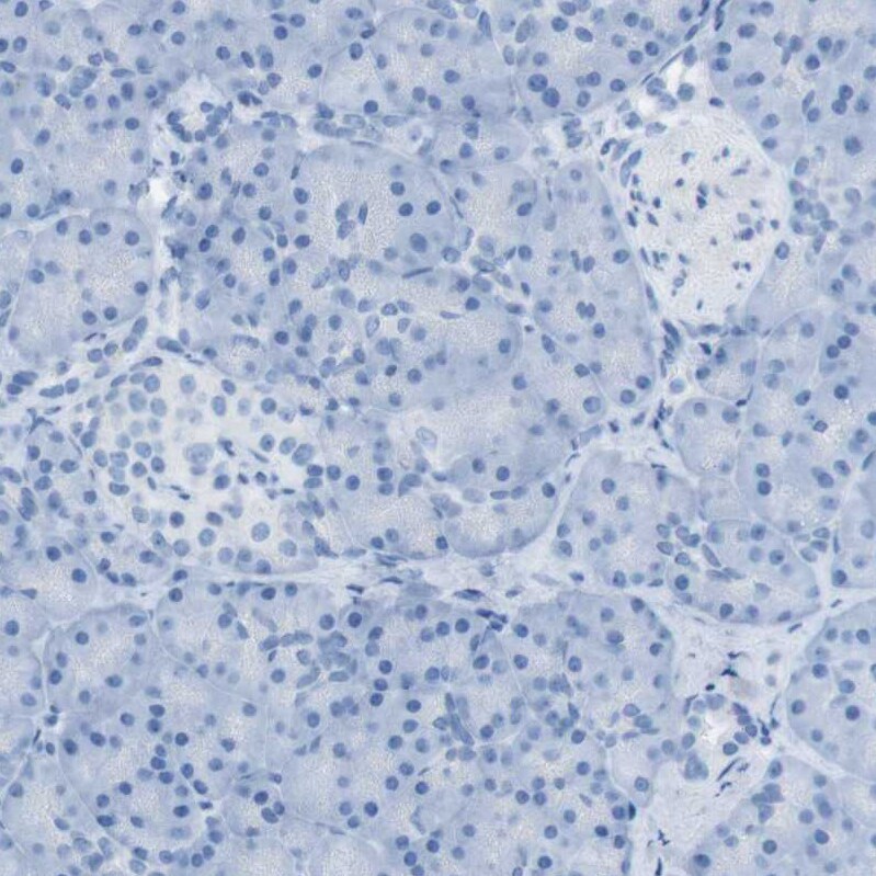 SALL4 Antibody - BSA Free Immunohistochemistry-Paraffin: SALL4 Antibody [NBP1-85206]