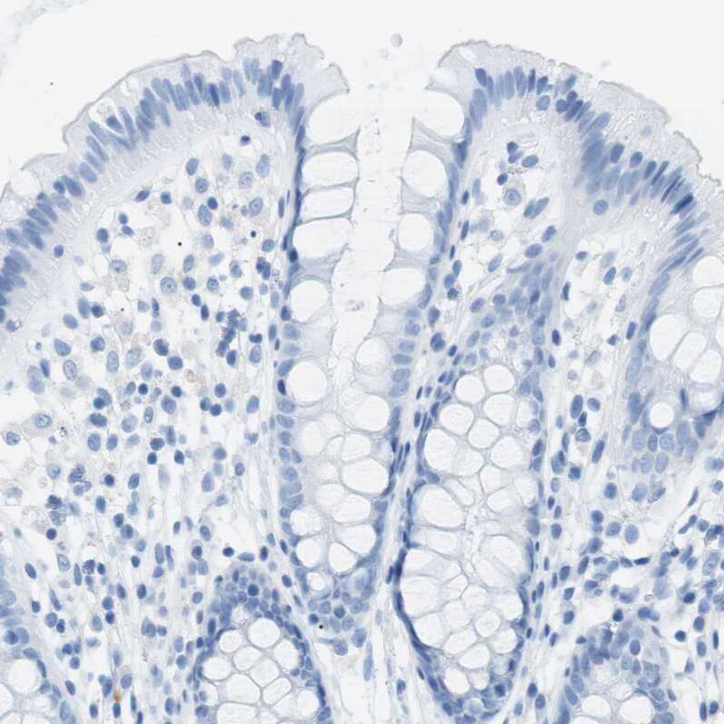 SALL4 Antibody - BSA Free Immunohistochemistry-Paraffin: SALL4 Antibody [NBP1-85206]