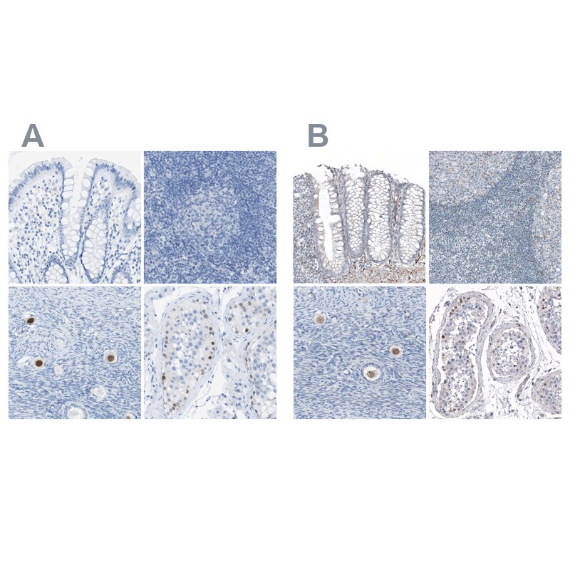 SALL4 Antibody - BSA Free Immunohistochemistry-Paraffin: SALL4 Antibody [NBP1-85206]