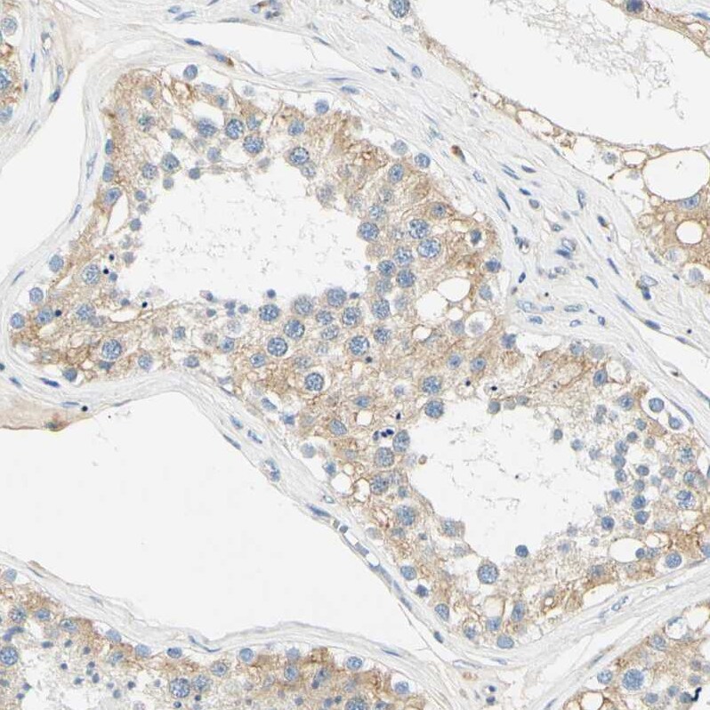 DNAJB12 Antibody - BSA Free Immunohistochemistry-Paraffin: DNAJB12 Antibody [NBP1-85208]