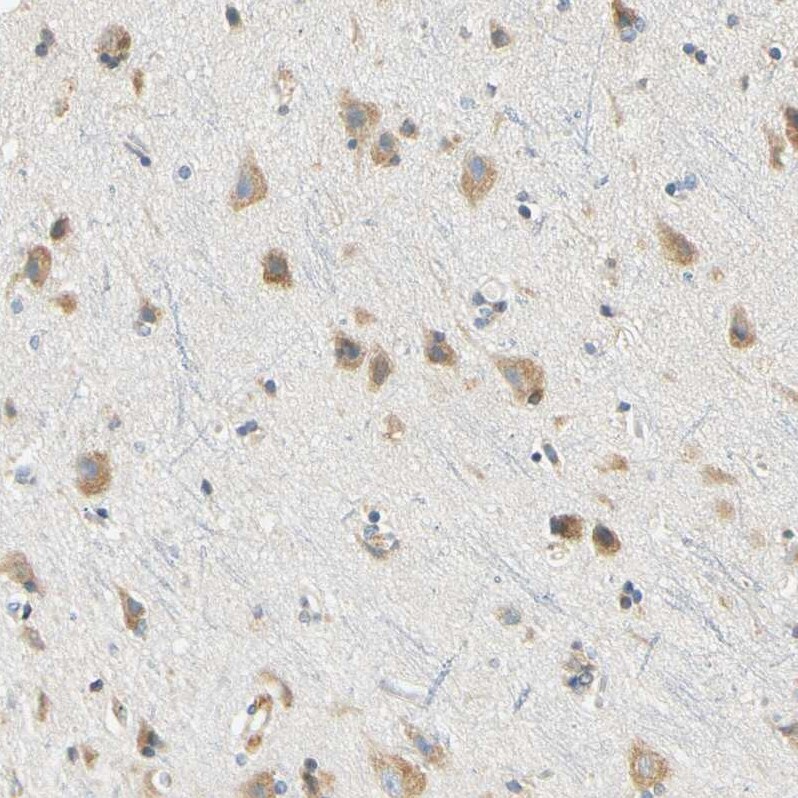 DNAJB12 Antibody - BSA Free Immunohistochemistry-Paraffin: DNAJB12 Antibody [NBP1-85208]