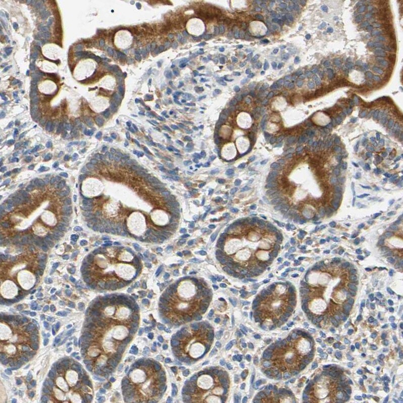 DNAJB12 Antibody - BSA Free Immunohistochemistry-Paraffin: DNAJB12 Antibody [NBP1-85208]