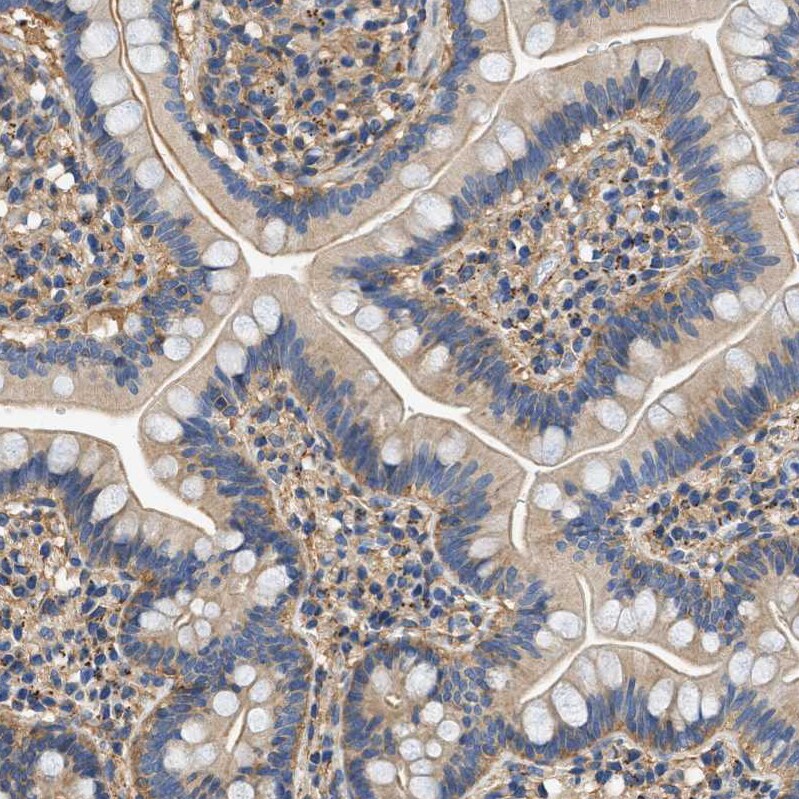 Septin-2 Antibody - BSA Free Immunohistochemistry-Paraffin: Septin-2 Antibody [NBP1-85212]