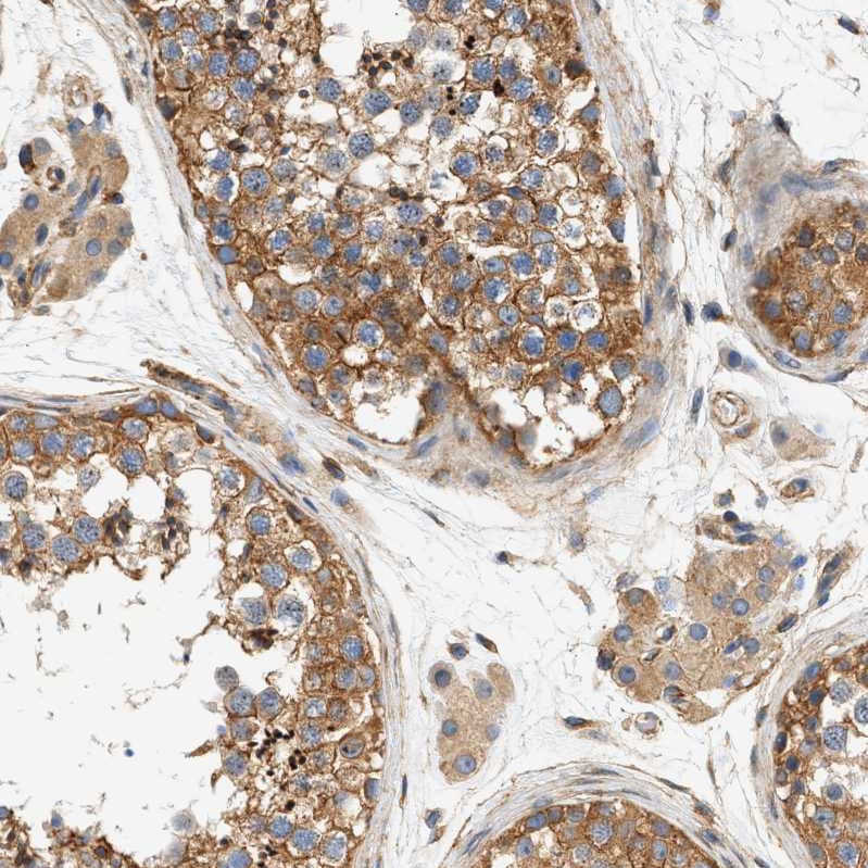 Septin-2 Antibody - BSA Free Immunohistochemistry-Paraffin: Septin-2 Antibody [NBP1-85212]