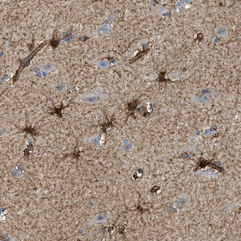Septin-2 Antibody - BSA Free Immunohistochemistry-Paraffin: Septin-2 Antibody [NBP1-85212]