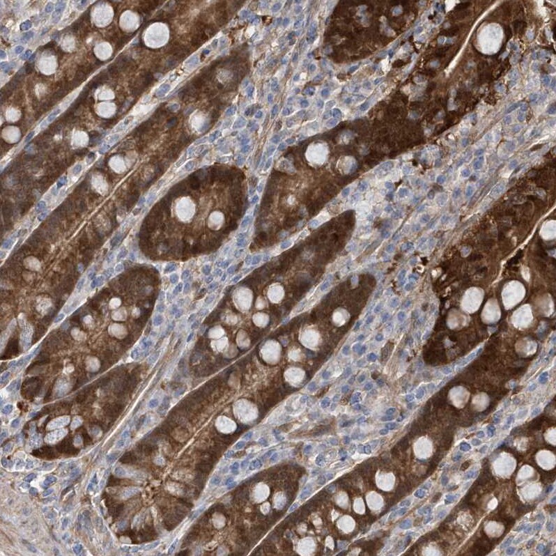 BDH2 Antibody - BSA Free Immunohistochemistry-Paraffin: BDH2 Antibody [NBP1-85218]