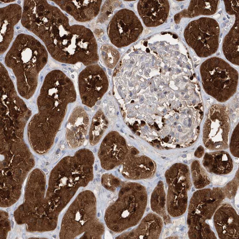 BDH2 Antibody - BSA Free Immunohistochemistry-Paraffin: BDH2 Antibody [NBP1-85218]