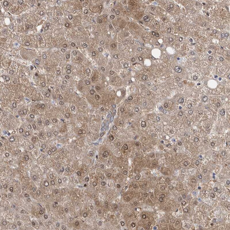 BDH2 Antibody - BSA Free Immunohistochemistry-Paraffin: BDH2 Antibody [NBP1-85218]