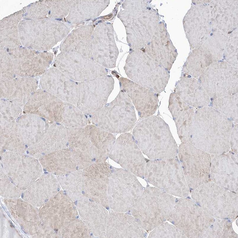 BDH2 Antibody - BSA Free Immunohistochemistry-Paraffin: BDH2 Antibody [NBP1-85218]