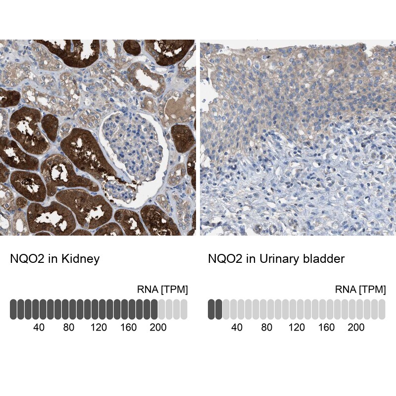 NQO-2 Antibody - BSA Free Immunohistochemistry-Paraffin: NQO-2 Antibody [NBP1-85221]