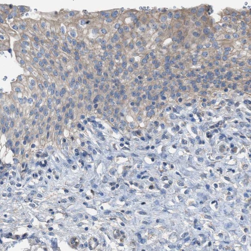 NQO-2 Antibody - BSA Free Immunohistochemistry-Paraffin: NQO-2 Antibody [NBP1-85221]