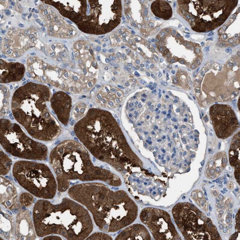 NQO-2 Antibody - BSA Free Immunohistochemistry-Paraffin: NQO-2 Antibody [NBP1-85221]