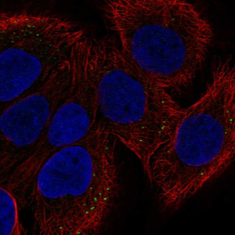ST2/IL-33R Antibody - BSA Free Immunocytochemistry/ Immunofluorescence: ST2/IL-33R Antibody [NBP1-85252]