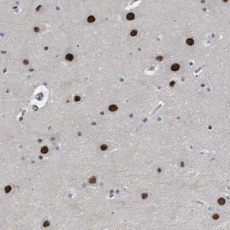 ENT2 Antibody - BSA Free Immunohistochemistry-Paraffin: ENT2 Antibody [NBP1-85253]