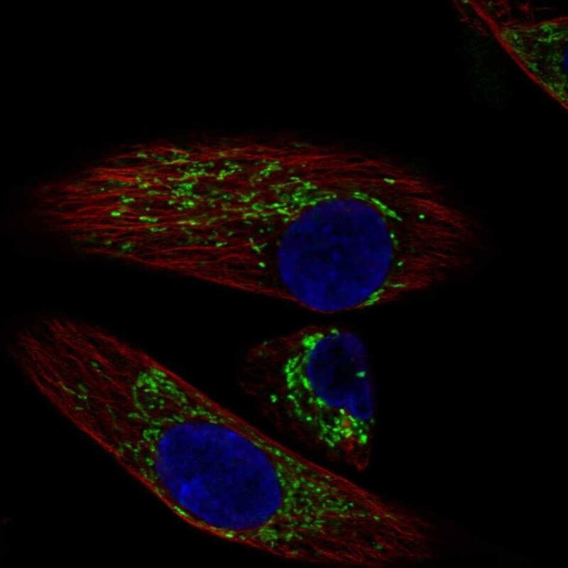 DEPTOR/DEPDC6 Antibody - BSA Free Immunocytochemistry/ Immunofluorescence: DEPTOR/DEPDC6 Antibody [NBP1-85255]