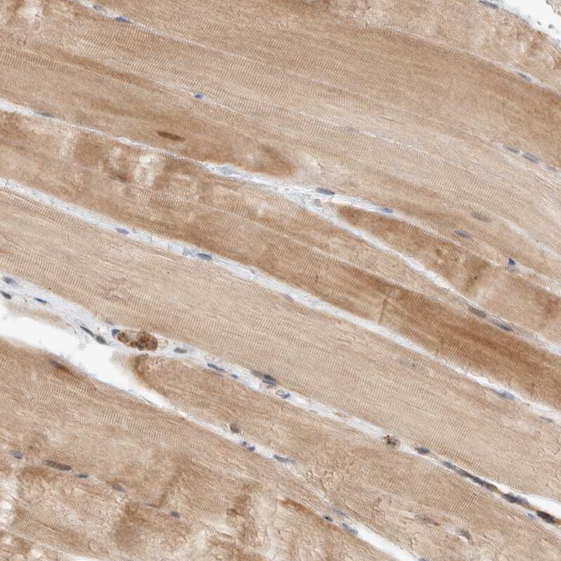 DEPTOR/DEPDC6 Antibody - BSA Free Immunohistochemistry-Paraffin: DEPTOR/DEPDC6 Antibody [NBP1-85257]