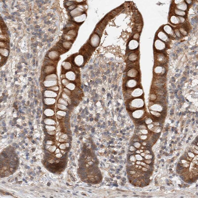 DEPTOR/DEPDC6 Antibody - BSA Free Immunohistochemistry-Paraffin: DEPTOR/DEPDC6 Antibody [NBP1-85257]