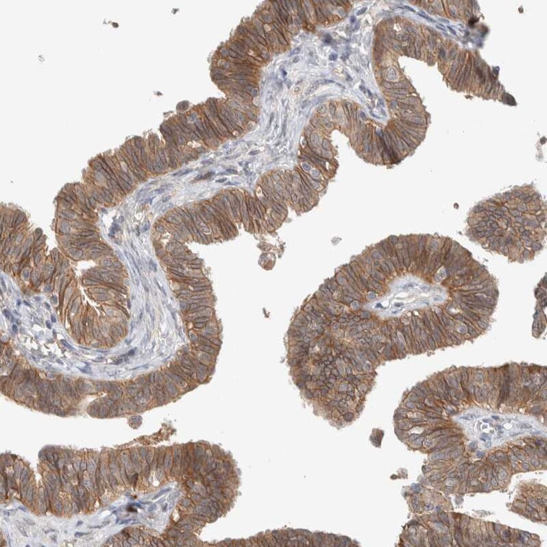 DEPTOR/DEPDC6 Antibody - BSA Free Immunohistochemistry-Paraffin: DEPTOR/DEPDC6 Antibody [NBP1-85257]