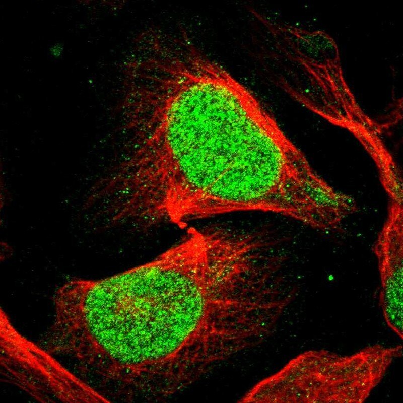 EIF4A3 Antibody - BSA Free Immunocytochemistry/ Immunofluorescence: EIF4A3 Antibody [NBP1-85268]