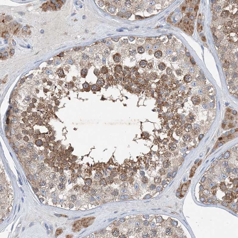 DHX30 Antibody - BSA Free Immunohistochemistry-Paraffin: DHX30 Antibody [NBP1-85270]