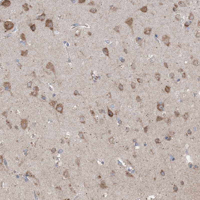 DHX30 Antibody - BSA Free Immunohistochemistry-Paraffin: DHX30 Antibody [NBP1-85270]