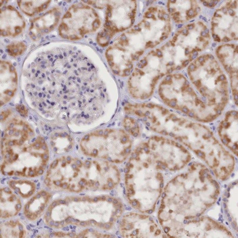 DCUN1D1 Antibody - BSA Free Immunohistochemistry-Paraffin: DCUN1D1 Antibody [NBP1-85275]