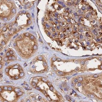 Dynactin Subunit 2/DCTN2/DCTN-50 Antibody - BSA Free Immunohistochemistry-Paraffin: Dynactin Subunit 2/DCTN2/DCTN-50 Antibody [NBP1-85278]